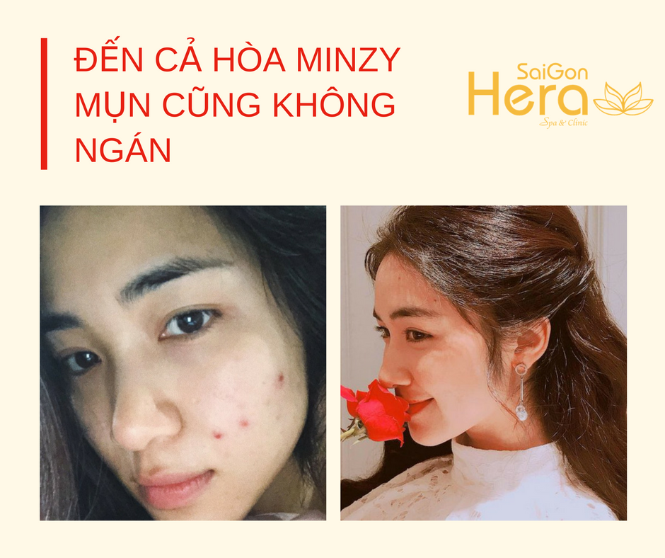 Sài Gòn Hera