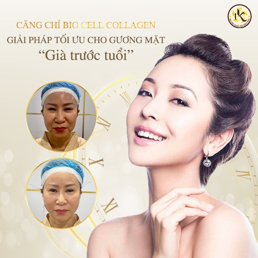 CĂNG CHỈ BIO CELL COLLAGEN