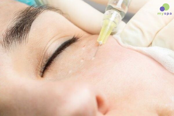 Liệu Trình Mesotherapy